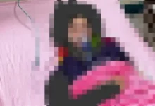 415