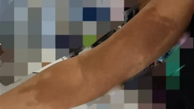 454