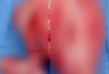 564