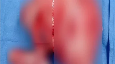 564